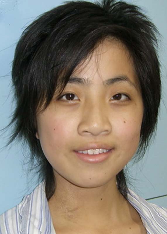 Li Xue