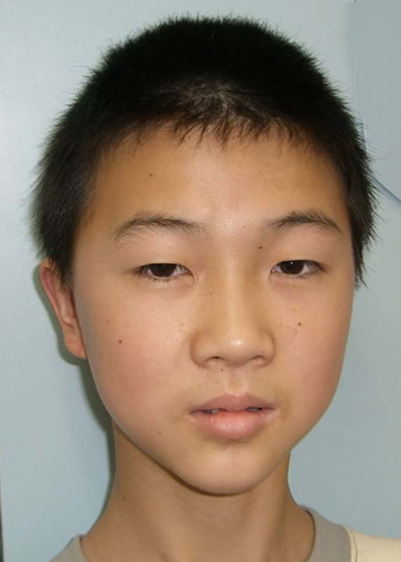 Guo Zao Xin