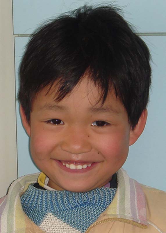 Ling Li Ping