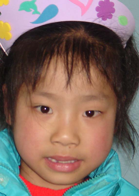 Zhang Yu