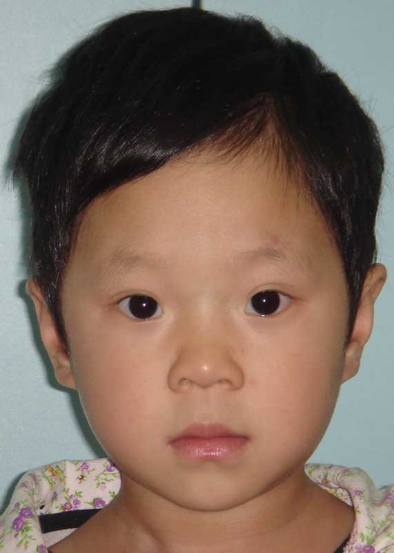 Zen Qiu Yi