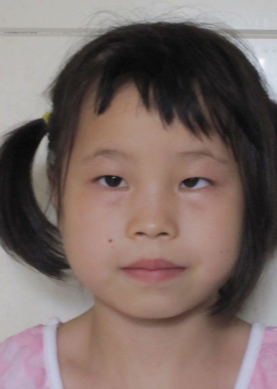 Xiong Ai